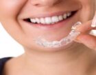 The Impact of Invisalign on Oral Health and Aesthetics in Chelsea