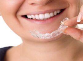 The Impact of Invisalign on Oral Health and Aesthetics in Chelsea