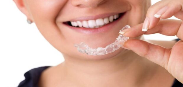 The Impact of Invisalign on Oral Health and Aesthetics in Chelsea